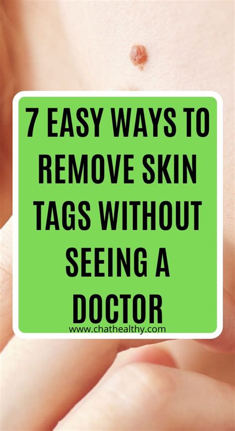 skin tags removal without harming yourself